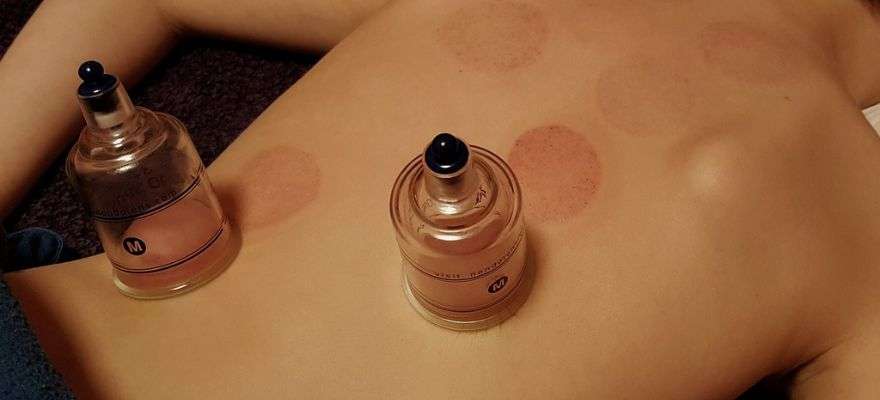 Cupping Therapy in Mumbai